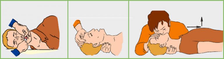 Рот в рот искусственное дыхание картинки