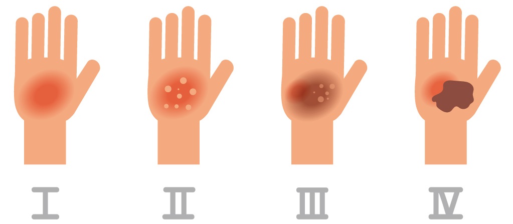 Негашеная известь и вода реакция фото Eurodom-ek.ru